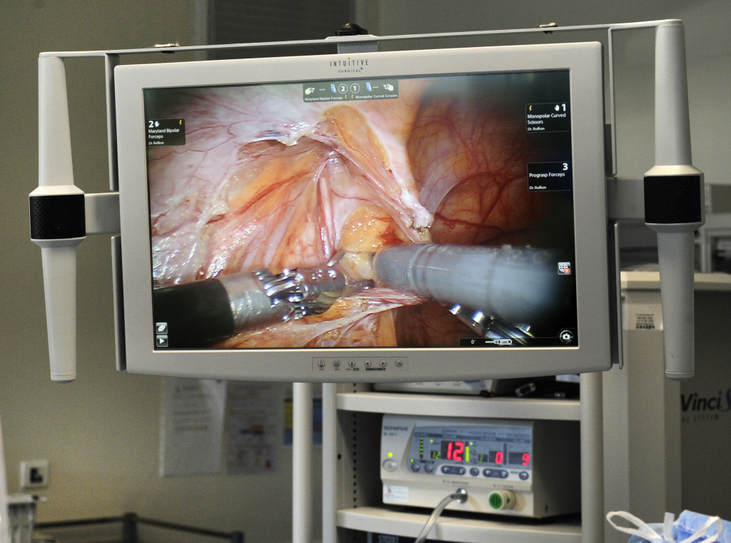 Ecran de contrôle du robot chirurgien