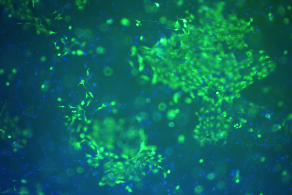 recherche in vitro - hépatocytes - maladies du foie