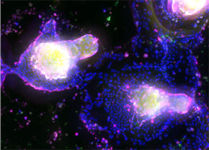 Organoïdes sur puce - Paludisme - INL - Sciences pour tous