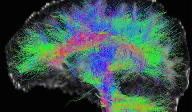 Images de tractographie par IRM de diffusion montrant les faisceaux de fibres cérébrales (Gabriel Kocevar, CREATIS ; CERMEP)